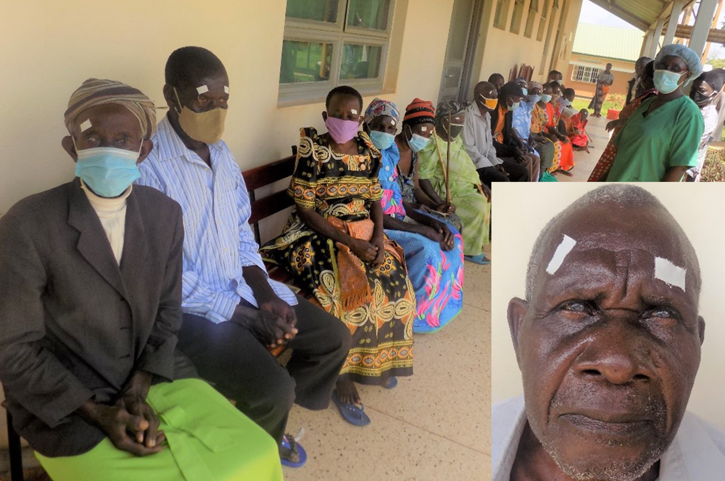 Eye-camps i Uganda